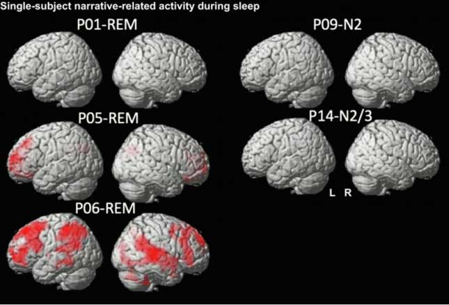 During sleep, slow electrical waves push waste products from deep within the brain